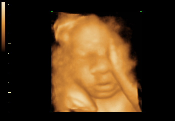 3d sonogram image at 32 weeks