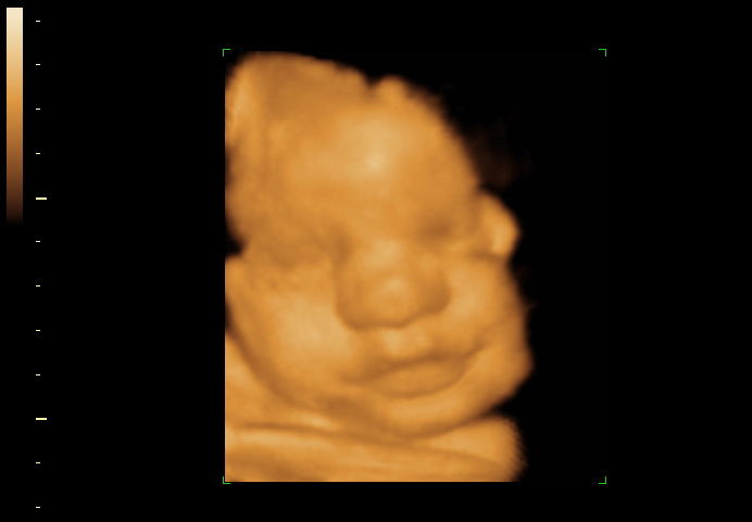 3d sonogram image at 32 weeks