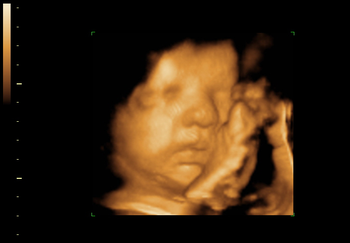 3d sonogram image at 32 weeks