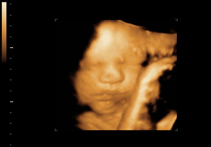 3d sonogram image at 32 weeks