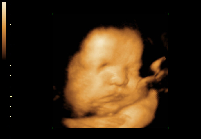 3d sonogram image at 32 weeks