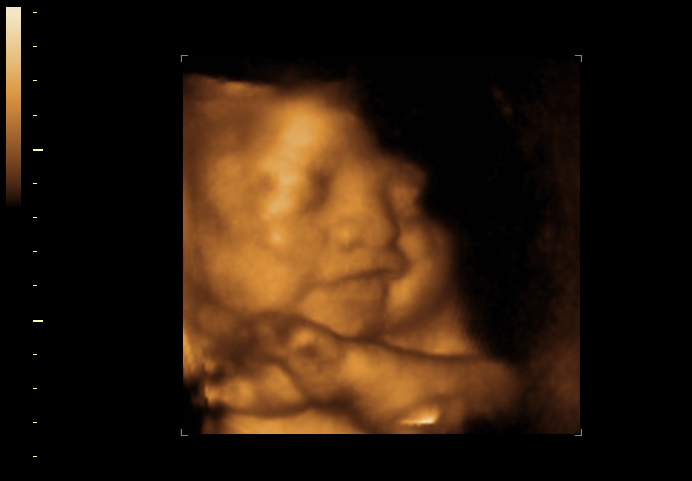 3d sonogram image at 33 weeks