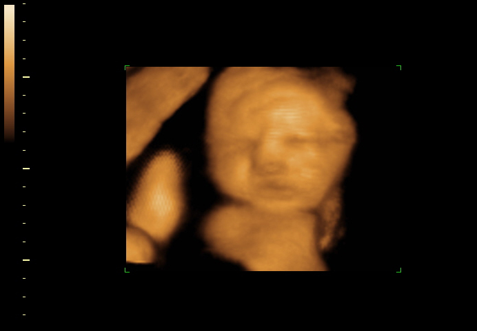 3d sonogram image at 33 weeks