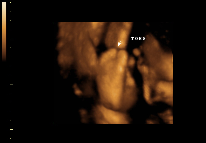 3d sonogram image at 33 weeks