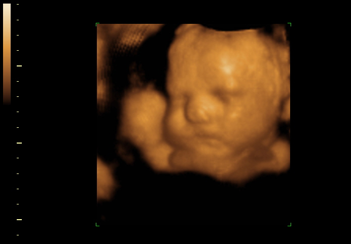 3d sonogram image at 33 weeks