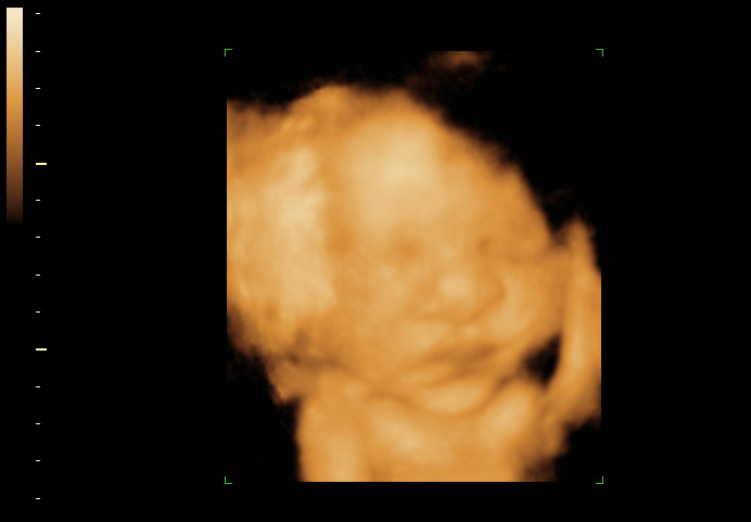 3d sonogram image at 33 weeks