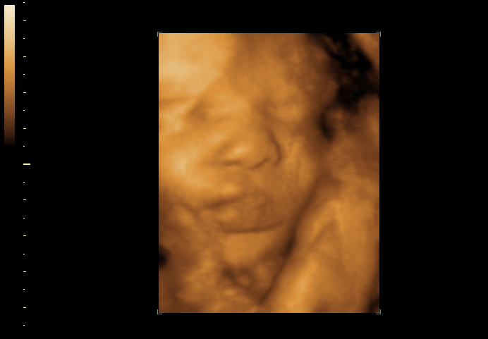 3d sonogram image at 34 weeks
