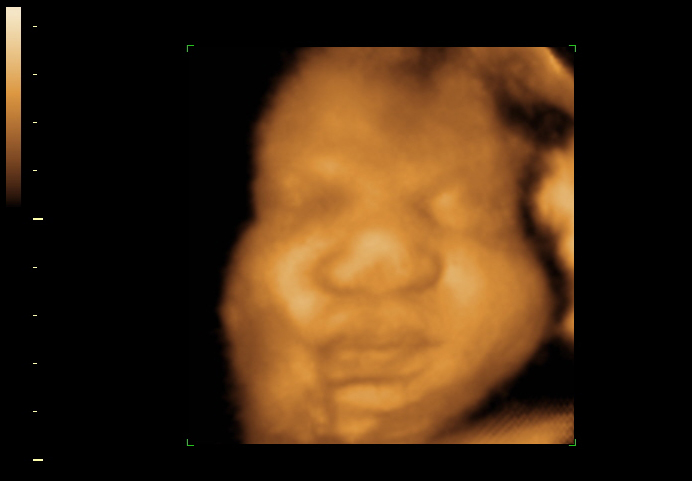 3d sonogram image at 34 weeks