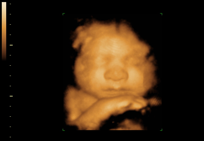 3d sonogram image at 35 weeks