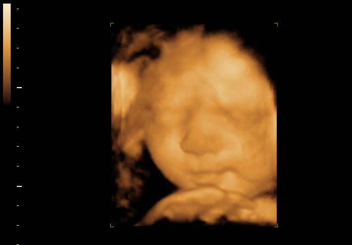 3d sonogram image at 35 weeks