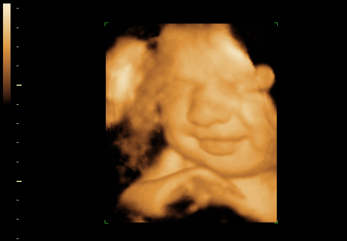 3d sonogram image at 35 weeks