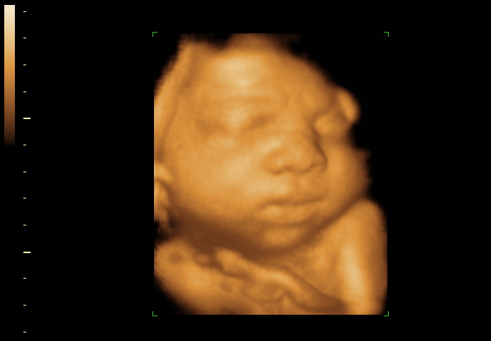 3d sonogram image at 36 weeks