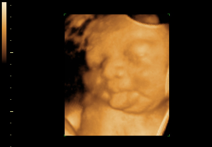 3d sonogram image at 36 weeks