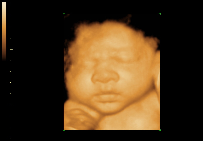3d sonogram image at 36 weeks