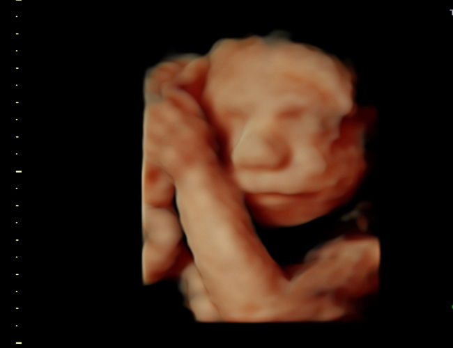 3d sonogram image at HD weeks