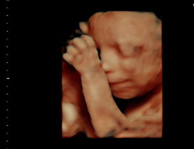 3d sonogram image at HD weeks