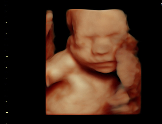 3d sonogram image at HD weeks