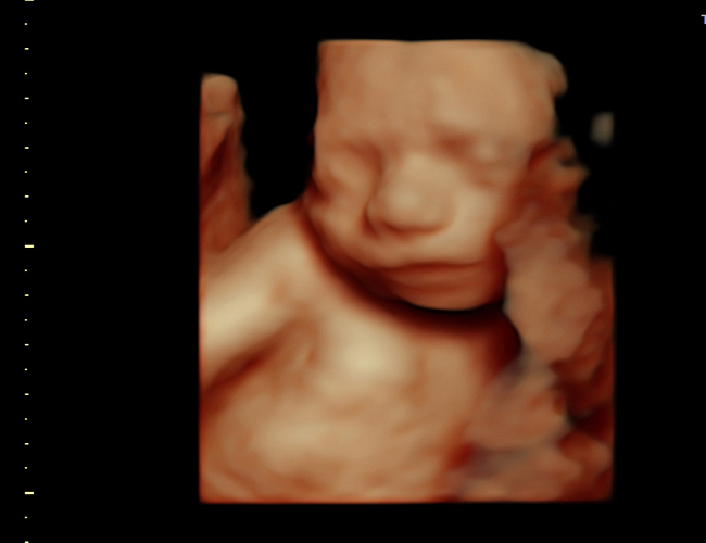 3d sonogram image at HD weeks