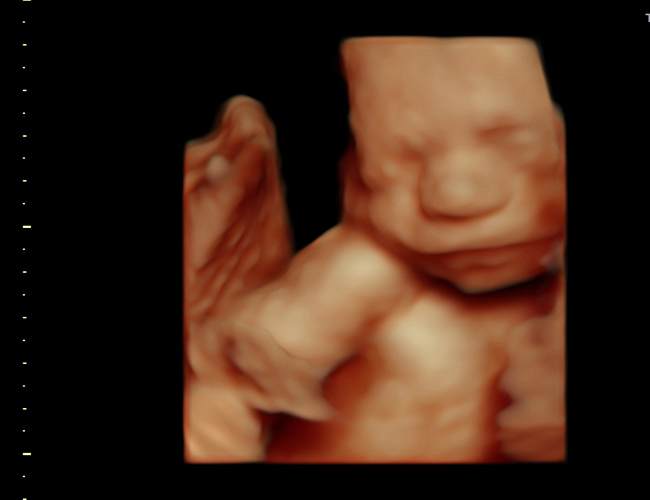 3d sonogram image at HD weeks