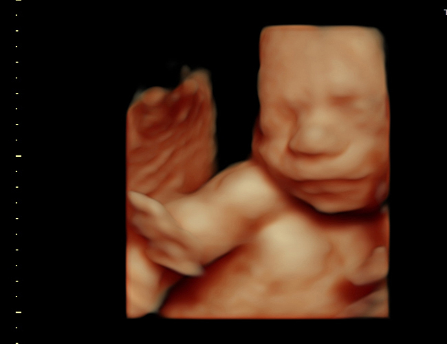 3d sonogram image at HD weeks