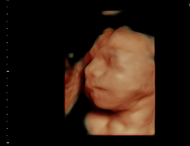 3d sonogram image at HD weeks