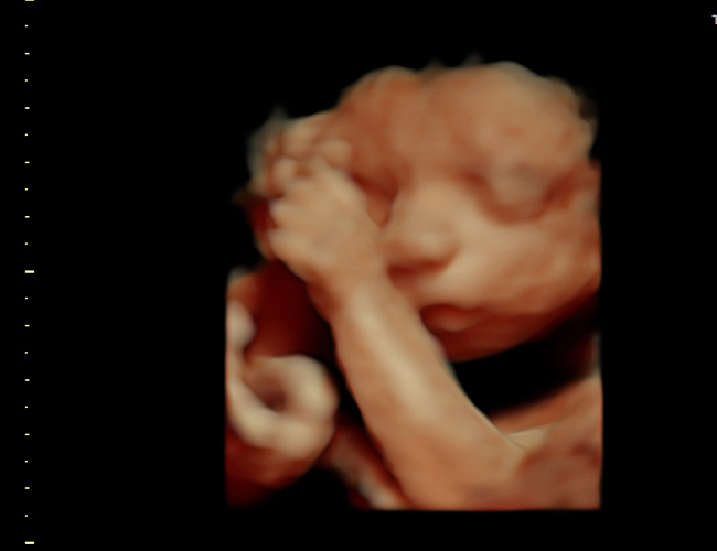 3d sonogram image at HD weeks