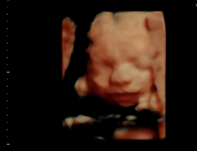 3d sonogram image at HD weeks