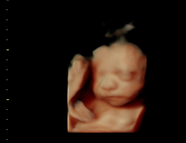 3d sonogram image at HD weeks