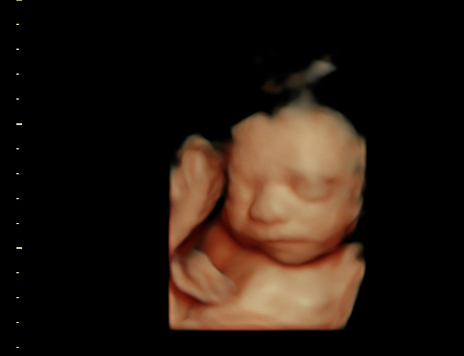 3d sonogram image at HD weeks