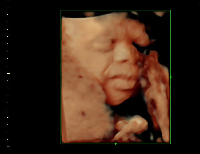 3d sonogram image at HD weeks