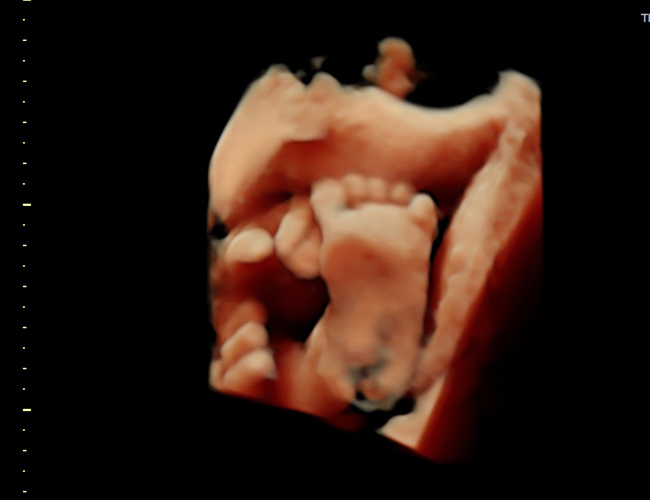 3d sonogram image at HD weeks