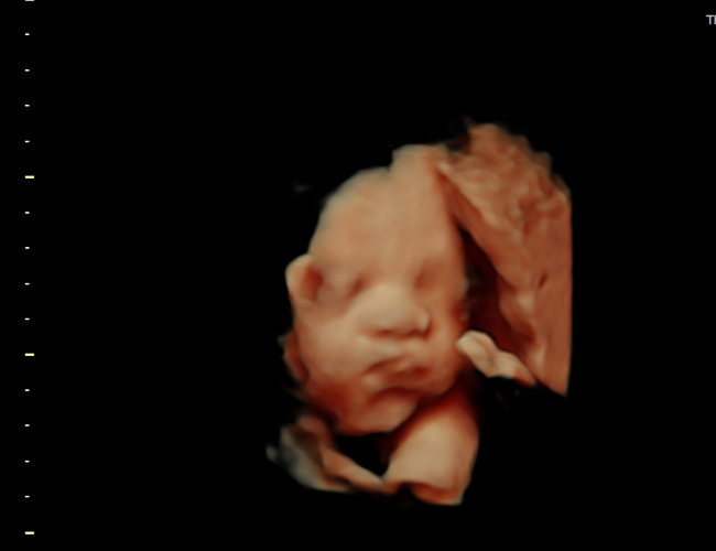 3d sonogram image at HD weeks