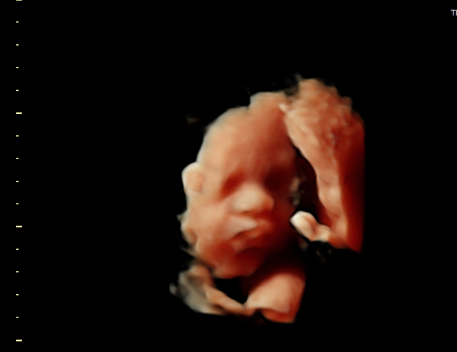 3d sonogram image at HD weeks