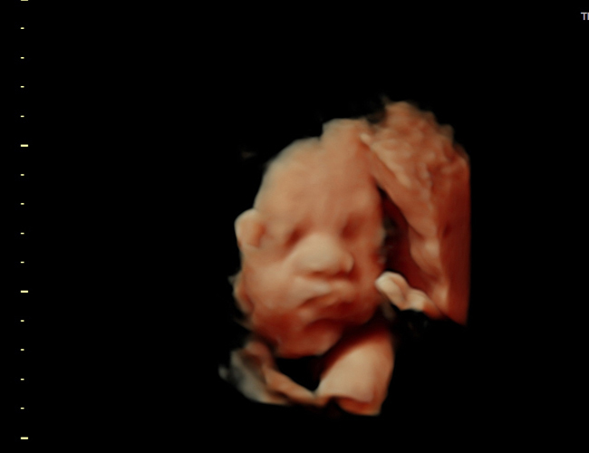 3d sonogram image at HD weeks