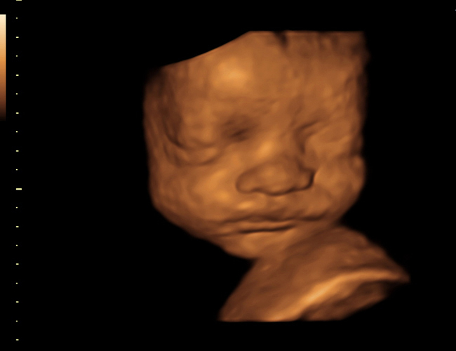 3d sonogram image at HD weeks