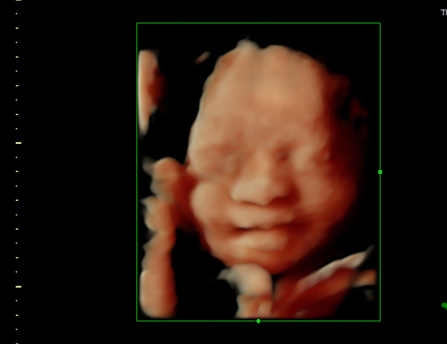 3d sonogram image at HD weeks