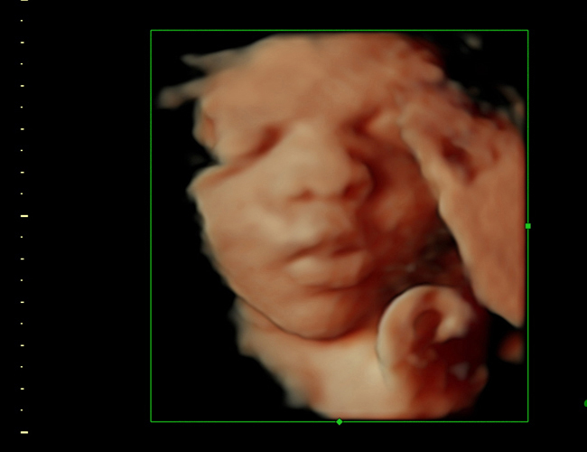 3d sonogram image at HD weeks