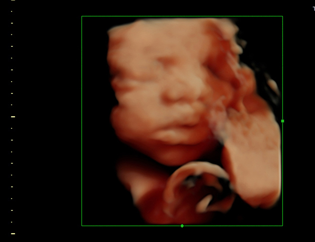 3d sonogram image at HD weeks