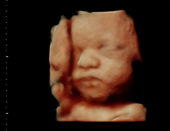 3d sonogram image at HD weeks