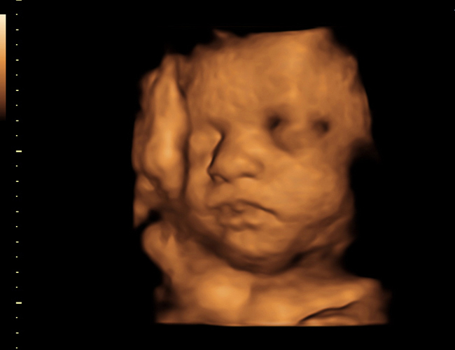 3d sonogram image at HD weeks