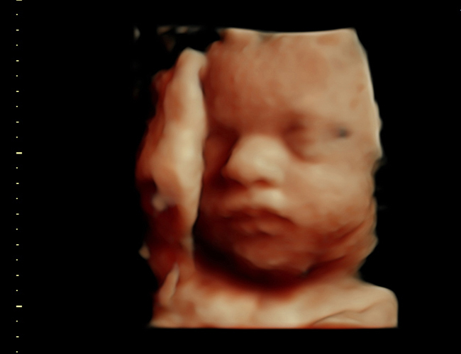 3d sonogram image at HD weeks