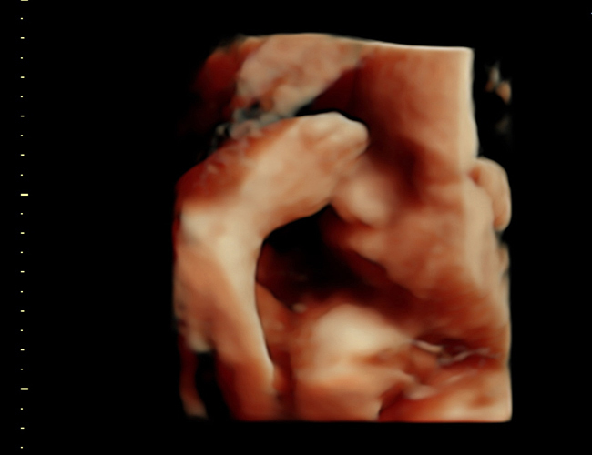 3d sonogram image at HD weeks