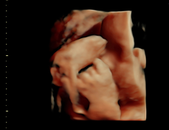 3d sonogram image at HD weeks