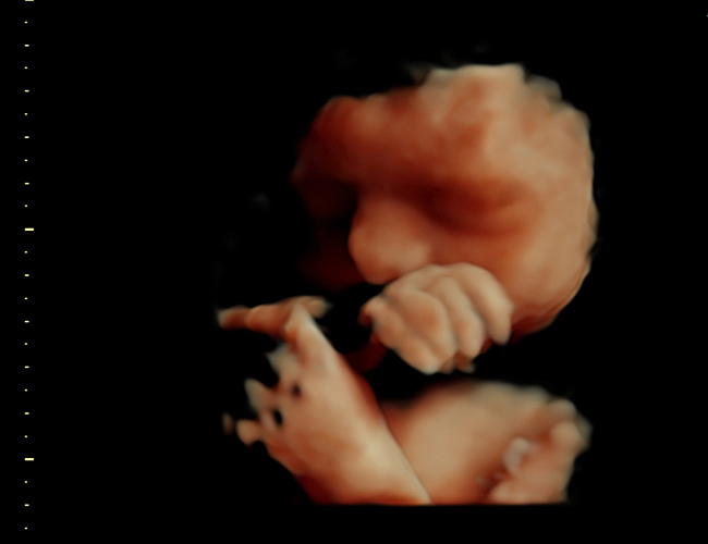 3d sonogram image at HD weeks