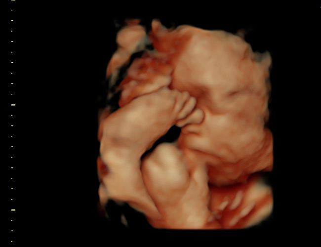 3d sonogram image at HD weeks