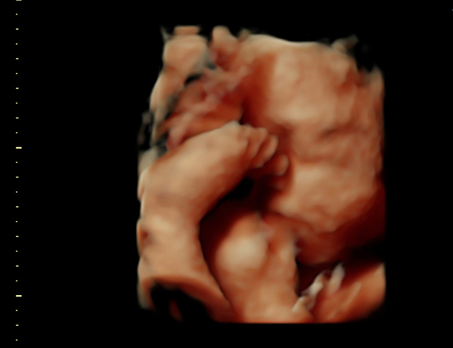 3d sonogram image at HD weeks