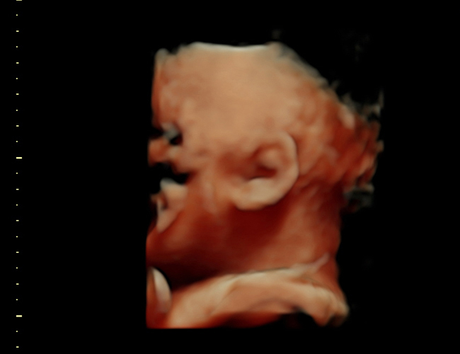 3d sonogram image at HD weeks