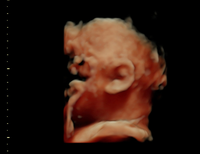 3d sonogram image at HD weeks