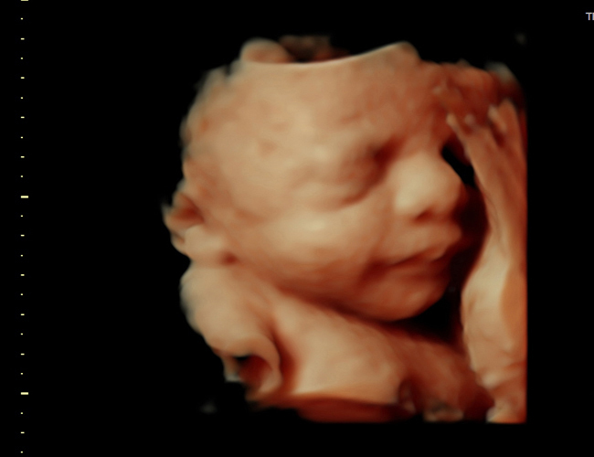 3d sonogram image at HD weeks