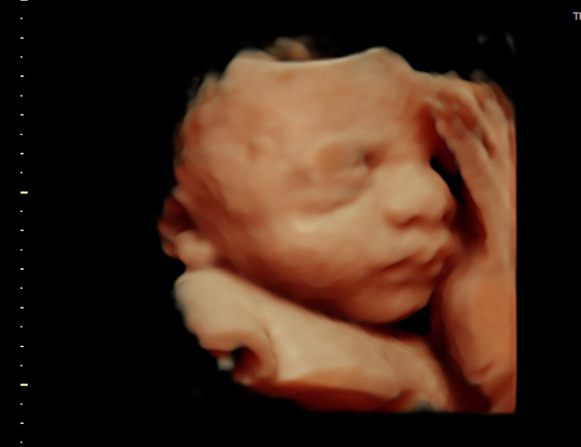 3d sonogram image at HD weeks